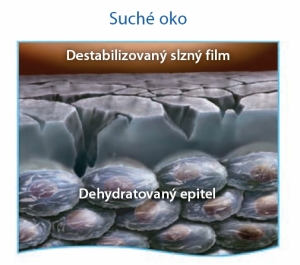 Profil povrchu suchého oka